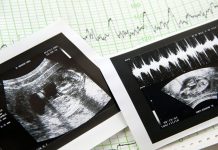 Prema studiji sve je više pobačaja na temelju spola