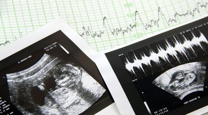 Prema studiji sve je više pobačaja na temelju spola