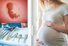 Trump ukinuo financiranje programima klinika za pobačaje 'Planned Parenthood' i preusmjerio sredstva centrima za zaštitu života