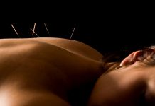 akupunktura