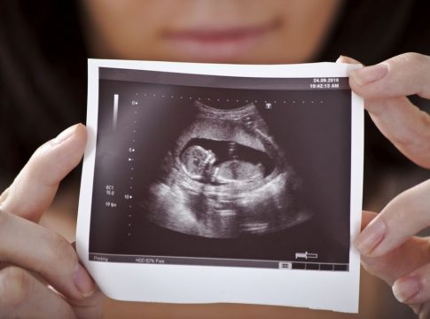 dijete ultrazvuk