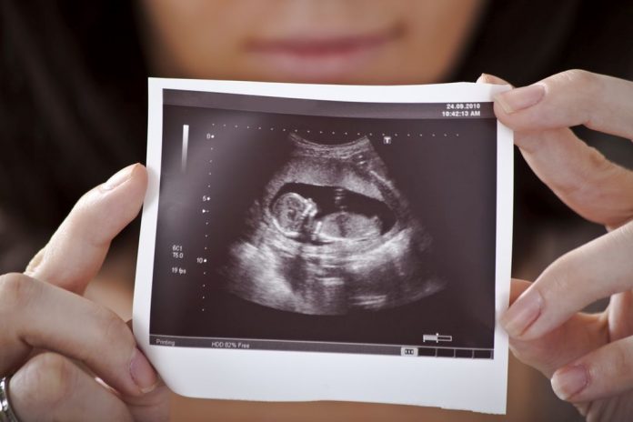 dijete ultrazvuk