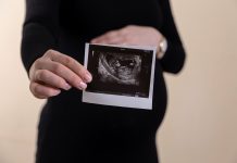 Nakon presude Vrhovnog suda SAD-a o pobačaju: Otkud razlike u brojanju tjedana kod trudnoće?