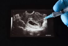Užas u Poljskoj: Usmrtili nerođenu bebu u 37. tjednu trudnoće iako majci nije bio ugrožen život